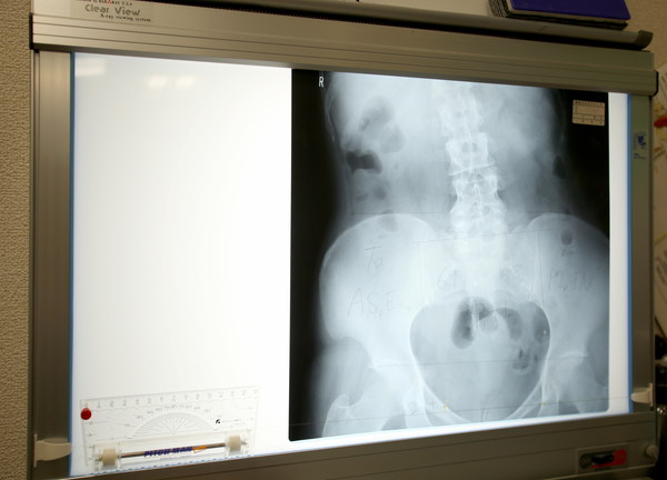 長野カイロプラクティック 博多院(きちんとご説明を行っております)