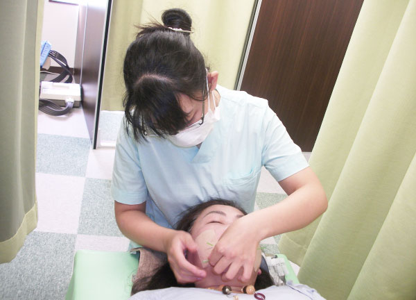 リカバリー整骨院　二日市院【鍼灸】(鍼（はり）施術の様子です)