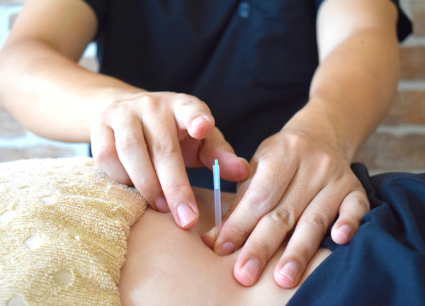 和幸はり灸整骨院【鍼灸】川棚駅院(つらい局所的な痛みは鍼で施術いたします。)