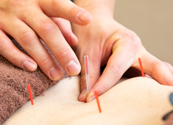 あい鍼灸院・接骨院　八戸ノ里駅院(鍼の力で本来持っている力を引き出します。)