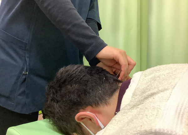 天王町そよかぜ鍼灸整骨院(鍼で本来の力を引き出します)