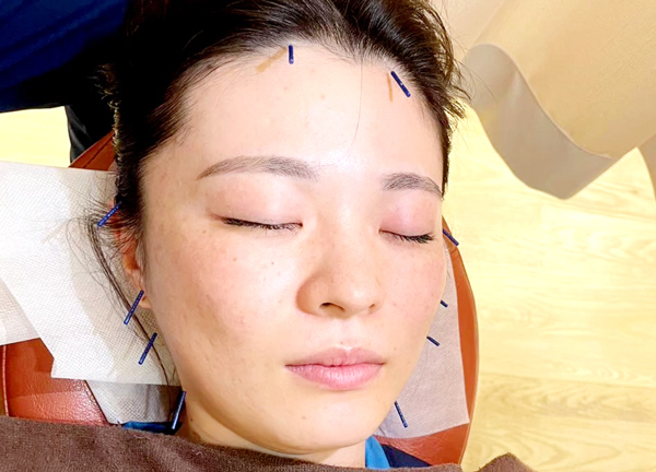 こころ整骨院　今川院【鍼灸】(美容鍼による施術にも対応しています。)