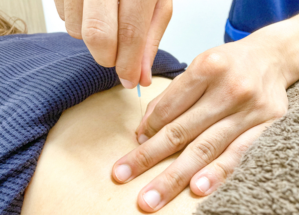 あおぞら整骨院 我孫子前駅院【鍼灸】(鍼で本来持っている力を引き出していきます。)