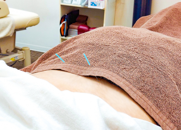 みのり整骨院　田辺院【鍼灸】(鍼で本来持っている力を引き出していきます)