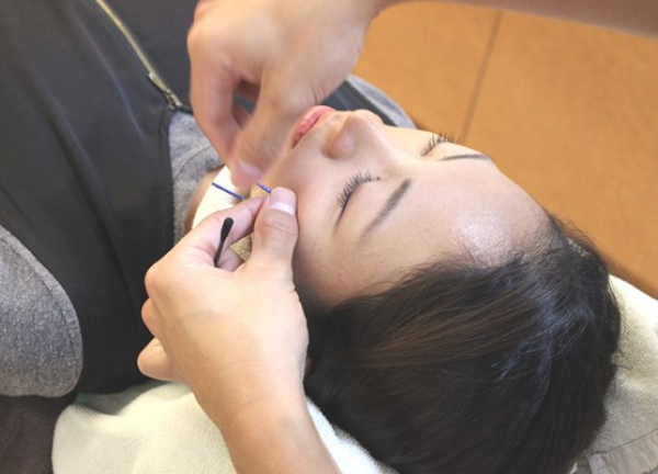 ＳＵＮ鍼灸整骨院(小顔美人コース（施術）)