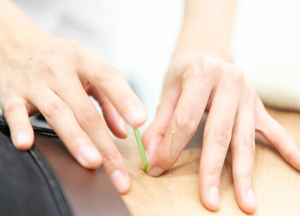 すずらん鍼灸接骨院　本山院(鍼灸にて深部までアプローチいたします。)