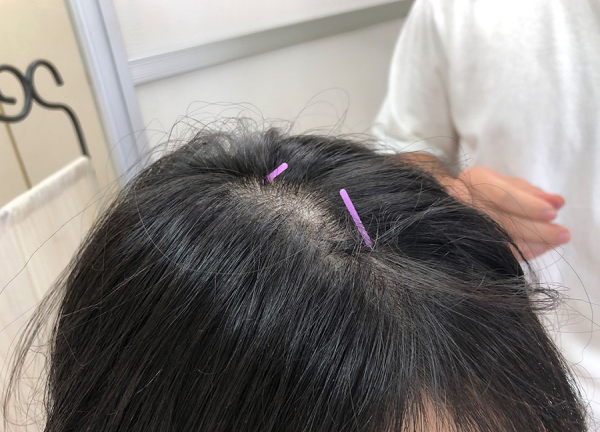 みち鍼灸治療院(痛みが少ない施術です。)