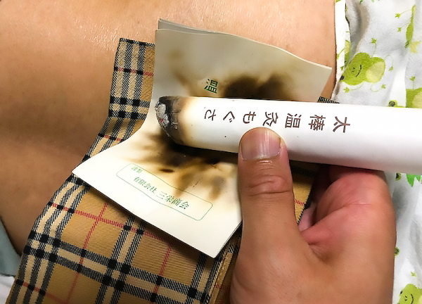 訪問鍼灸院らーく(お灸で血行促進などを行います。)