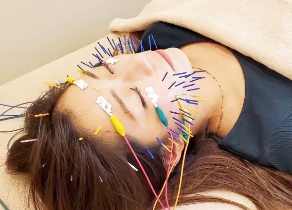 Ａｉｒ鍼灸院・接骨院(美容鍼の施術をしています)