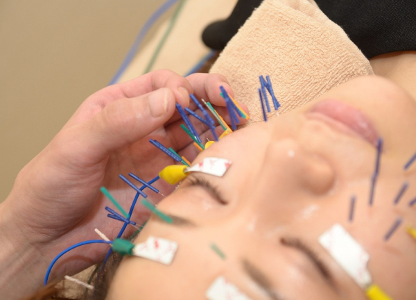 Ａｉｒ鍼灸院・接骨院(細い鍼を使用しているので、痛みは少ないです。)