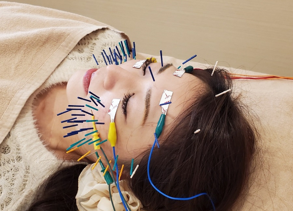 Ａｉｒ鍼灸院・接骨院(肌深層にある細胞や筋肉を刺激します。)