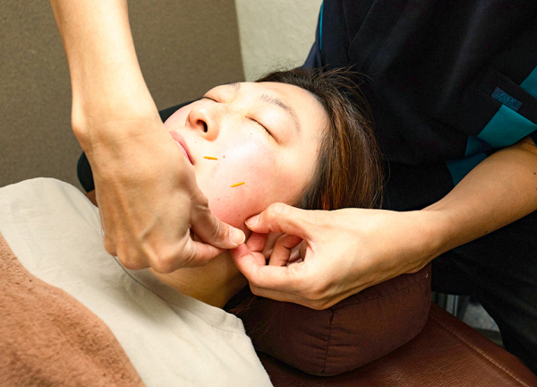 さくら鍼灸整骨院　上野院(お顔まわりの不調の解消を目指します)