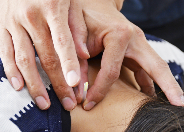 ワイズ整骨院／ワイズ鍼灸マッサージ院(細い鍼でアプローチするため、痛みはほぼございません。)