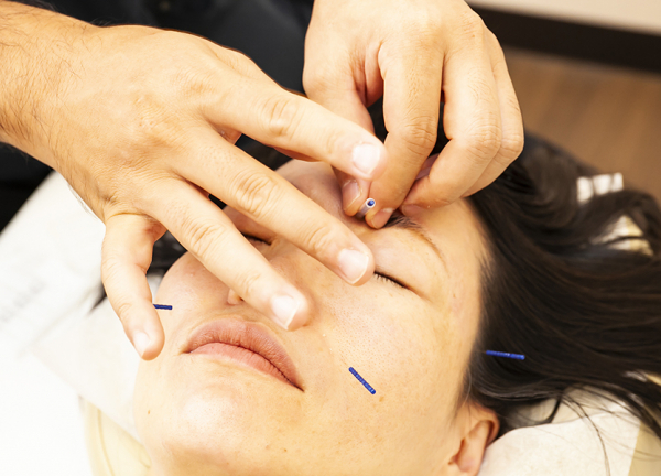 ワイズ那覇整骨院／ワイズ那覇鍼灸院(お顔の肌深層までアプローチします。)