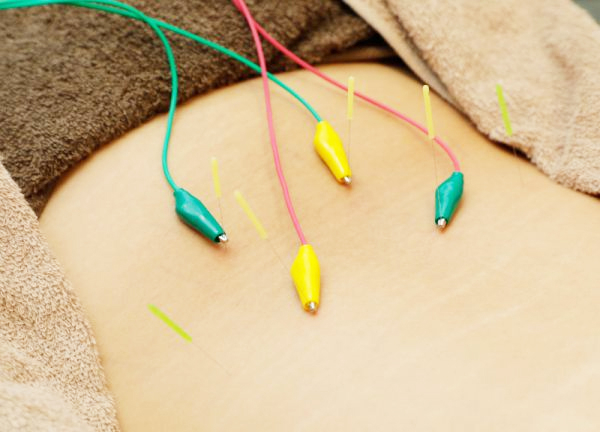 蘇摩鍼灸治療院竹内弘宜(電気鍼でお悩みの箇所にアプローチします。)