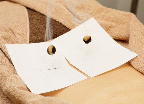 蘇摩鍼灸治療院竹内弘宜(身体の芯から温めます。)