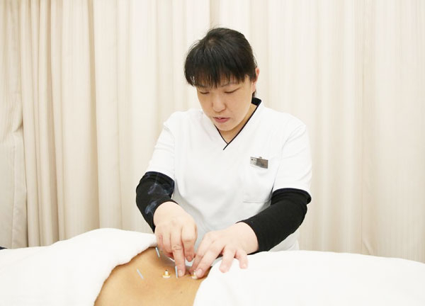 へいわの整骨院【鍼灸/マッサージ】(鍼灸による施術の様子です。)