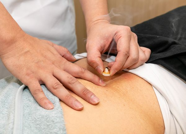 カムイ鍼灸整骨院(身体の芯から温めます。)