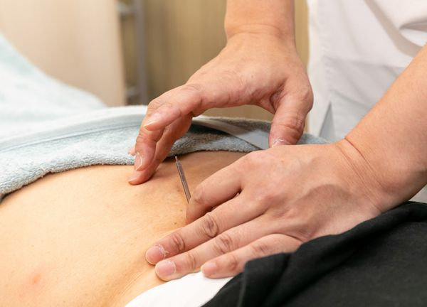 カムイ鍼灸整骨院(鍼により身体の深層にある筋肉にアプローチします。)