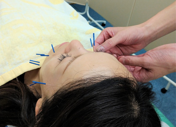 銀座鍼灸整骨院(美容鍼をお試しください。)