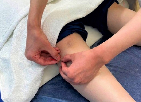 鍼灸整骨まこまない(鍼による施術の様子です。)