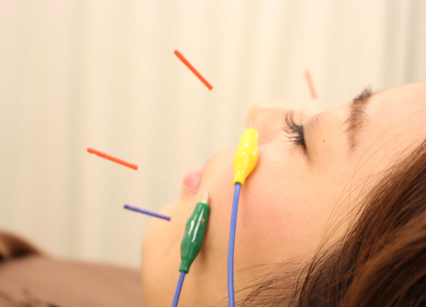 木賀鍼灸整骨院(美容鍼では電気を通して顔のリフトアップ効果が期待♪)