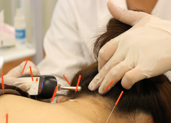 木賀鍼灸整骨院(鍼+電気で効果が期待できる施術を◎)