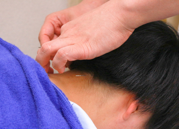 Ｆ．Ｃ．Ｃ．築地鍼灸整骨院【マッサージ】(鍼によるアプローチでお悩みの根本改善へ！)