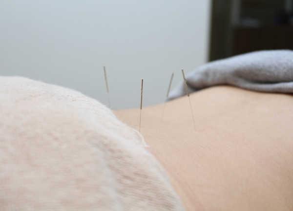 Ｆ．Ｃ．Ｃ．蒲田鍼灸整骨院(細い鍼で施術するのでほとんど痛みはございません★)