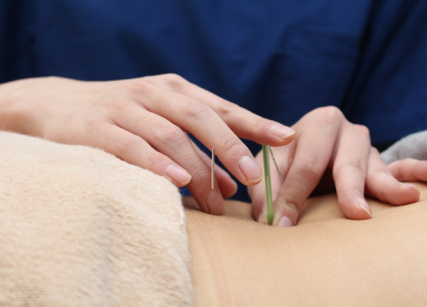 Ｆ．Ｃ．Ｃ．蒲田鍼灸整骨院(一本一本丁寧に鍼を刺していきます！)