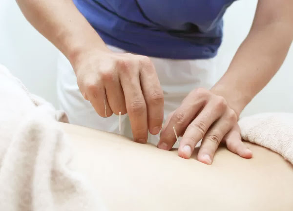 からだらか鍼灸整骨院　洗足池院(一本一本丁寧に鍼を刺していきます♪)