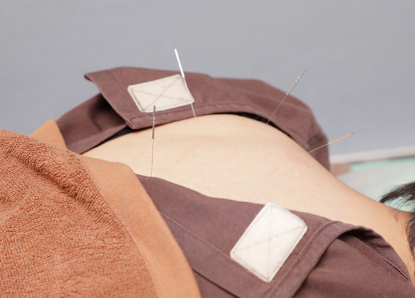 ハリライフ大井町鍼灸整骨院(本来持っている力を引き出し、整えていきます★)