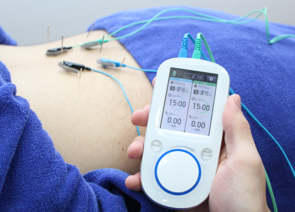 Ｆ．Ｃ．Ｃ．よみうりランド鍼灸整骨院（アメリア稲城様2階）(電気を流して筋肉に刺激を与えます★)