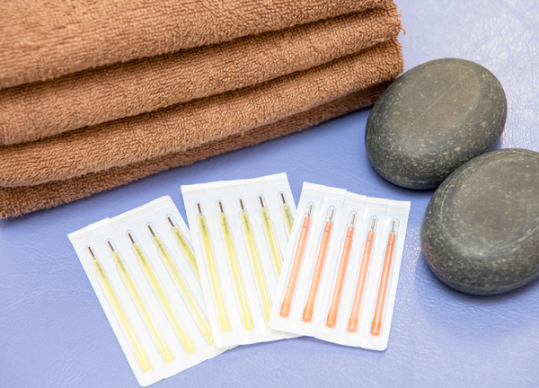 神田鍼灸整骨院　3号店　司町院(鍼はディスポーザブル（使い捨て）を使用しております。)