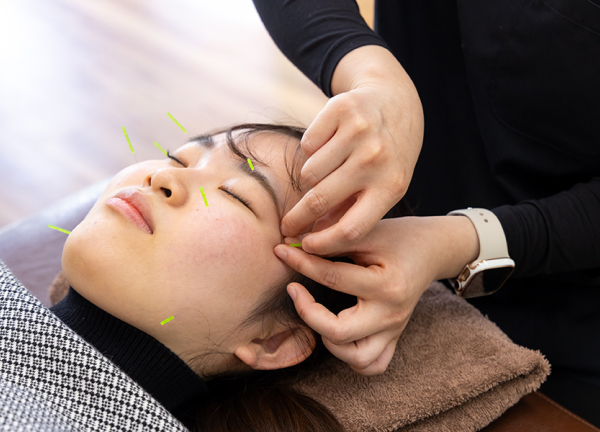 北野あおば鍼灸整骨院(美容鍼で肌深層へアプローチします。)