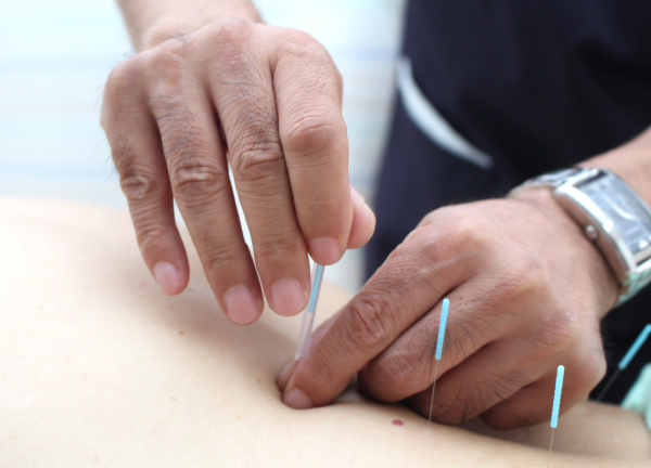 ことぶき整骨院・鍼灸院　武蔵浦和店(つらい局所的な痛みは鍼にお任せください◎)