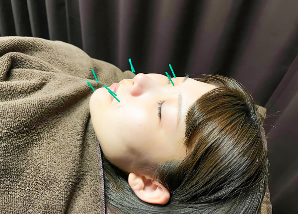 ようがナチュラル整骨院(お顔のたるみやシワの改善を目指します。)