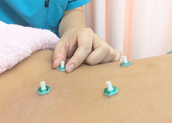 さくら整骨院・はりきゅう院　上板橋駅院(お灸でツボを刺激して代謝向上を目指します。)