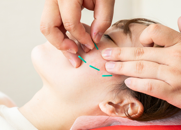 ＶＩＶＡ鍼灸接骨整体院　東岸和田駅東口院(肌深層にある細胞を刺激して潤いある肌へ。)