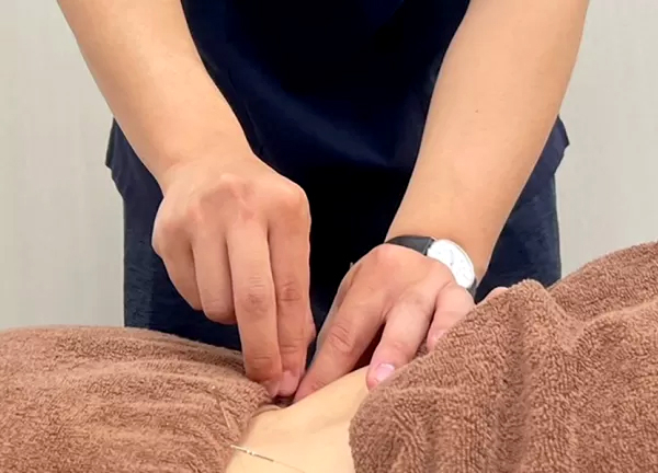 甲斐整骨院　新宮院【鍼灸】(体表にあるツボを刺激して自律神経の乱れを整えます。)