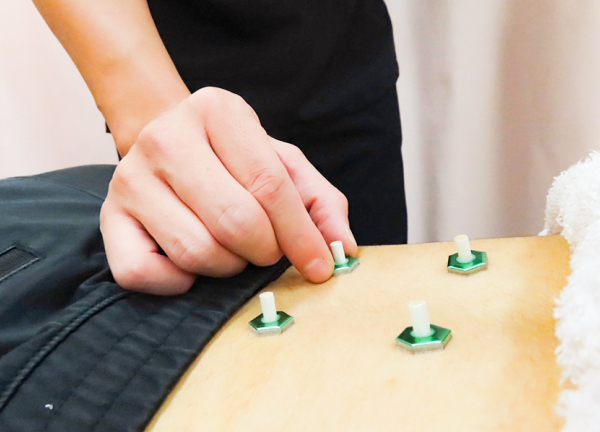 さくらはりきゅう整骨院　中板橋駅院(お灸でツボを刺激して代謝向上を目指します。)