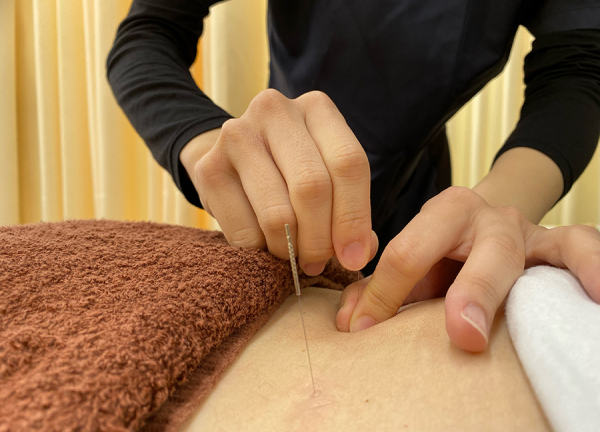 ひだまり鍼灸整骨院(鍼灸で筋肉の弛緩や血行促進、自律神経の調整をおこないます)