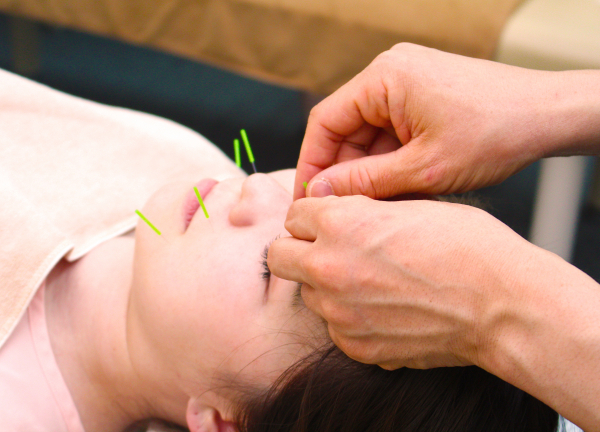 セントラル接骨院　西台【鍼灸】(美容鍼はしわやたるみ、顔のリフトアップ効果が期待されます)