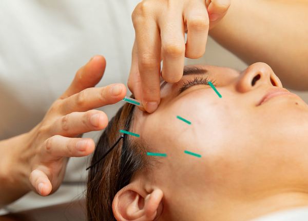 いろはに整骨院・鍼灸院(細い鍼で施術するのでほとんど痛みはございません！)