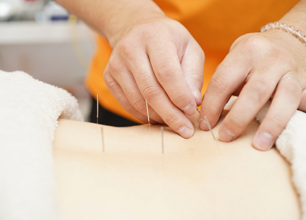 ひだまり整骨院・ひだまり鍼灸マッサージ院 (細い鍼を使用していますので、痛みは少ないです。)
