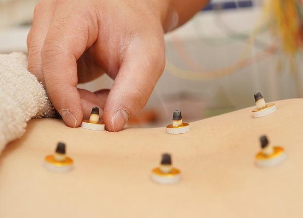 ひだまり整骨院・ひだまり鍼灸マッサージ院 (お灸でお身体を温めましょう。)