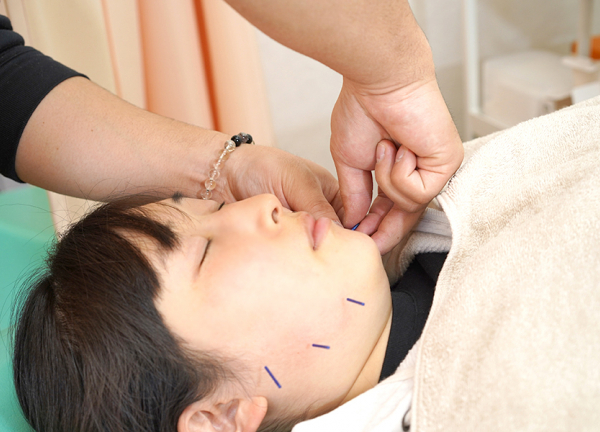 ひだまり整骨院・ひだまり鍼灸マッサージ院 (マスクなどの肌荒れも美容鍼にお任せください。)