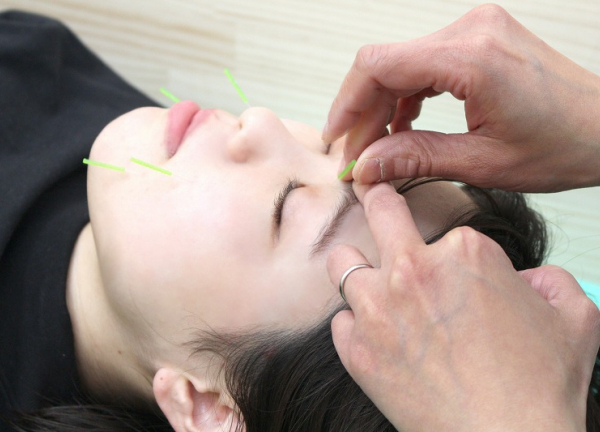 野本鍼灸整骨院　都島院(肌の深層を刺激して、本来持っている力を引き出します。)