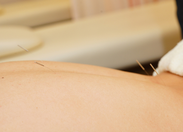 古淵あおば整骨院はりきゅう院(鍼灸で本来持っている力を引き出します。)