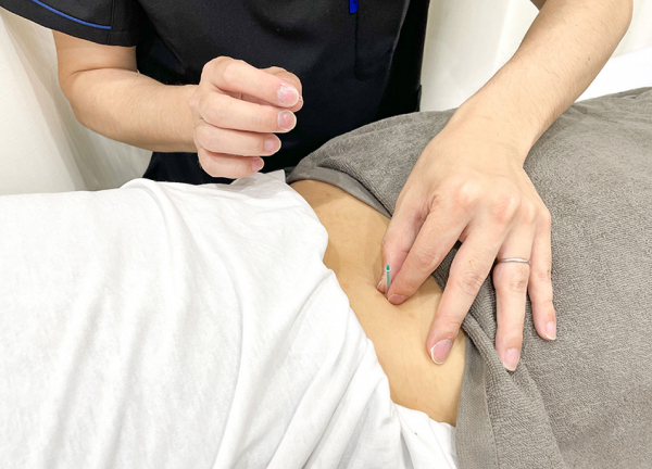 文の里駅前整骨院　阿倍野区院【鍼灸】(身体中にある経穴(ツボ)を刺激して、体内を整えます。)